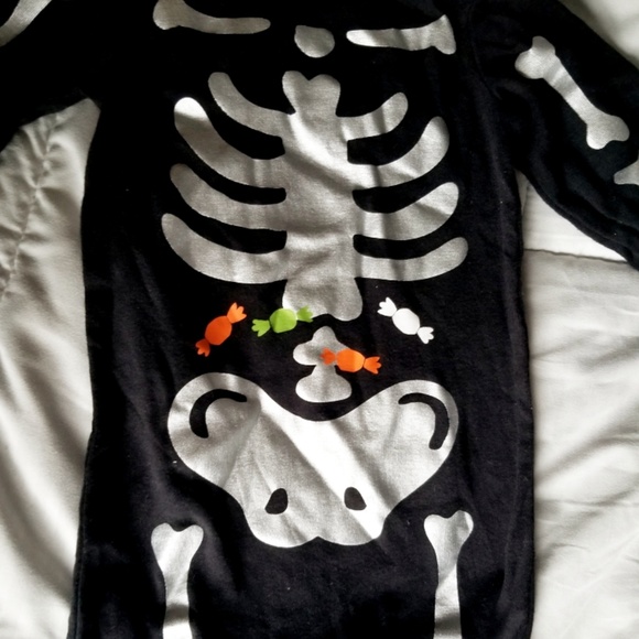 Skeleton One Piece - Picture 1 of 2
